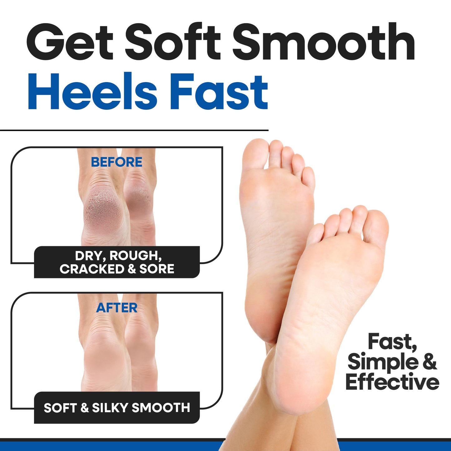 Moisturizing Heel Socks (3 Pairs)